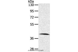Western blot analysis of Human lymphoma tissue, using CDK10 Polyclonal Antibody at dilution of 1:100 (CDK10 Antikörper)