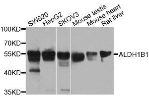 Western blot analysis of extracts of various cell lines, using ALDH1B1 antibody. (ALDH1B1 Antikörper  (AA 278-517))