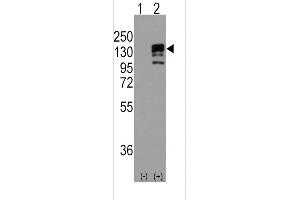 Western Blotting (WB) image for anti-Cadherin 1, Type 1, E-Cadherin (Epithelial) (CDH1) (AA 160-189), (N-Term) antibody (ABIN5534948)