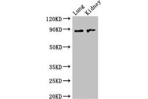 Western Blot Positive WB detected in: Mouse lung tissue, Mouse kidney tissue All lanes: NAALADL2 antibody at 3. (NAALADL2 Antikörper  (AA 143-795))
