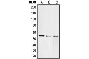 Western blot analysis of RAP1A expression in HEK293T (A), HeLa (B), PC12 (C) whole cell lysates. (RAP1A Antikörper  (Center))
