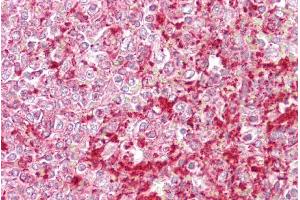 Immunohistochemistry with Spleen tissue at an antibody concentration of 5µg/ml using anti-ETV5 antibody (ARP31658_P050) (ETV5 Antikörper  (N-Term))