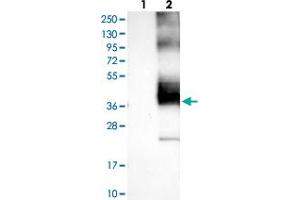 Western blot analysis of Lane 1: Negative control (vector only transfected HEK293T lysate), Lane 2: Over-expression Lysate (Co-expressed with a C-terminal myc-DDK tag (~3. (KCNK1 Antikörper)