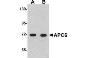 Western blot analysis of APC6 in human liver tissue lysate with AP30062PU-N APC6 antibody at (A) 1 and (B) 2 μg/ml. (CDC16 Antikörper  (N-Term))