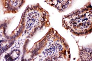 Immunohistochemistry (IHC) image for anti-Lactate Dehydrogenase A (LDHA) (AA 2-106) antibody (ABIN4886657)
