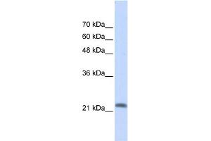 WB Suggested Anti-RASL10A Antibody Titration: 0.