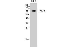 Western Blotting (WB) image for anti-PAK5/6 (Ser1197) antibody (ABIN3176756) (PAK5/6 (Ser1197) Antikörper)