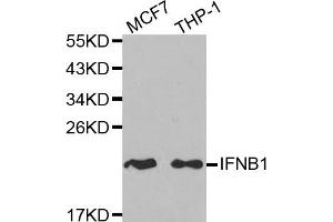 Western blot analysis of extracts of MCF7 and THP-1 cell lines, using IFNB1 antibody. (IFNB1 Antikörper)