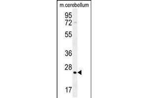 Western blot analysis in mouse cerebellum tissue lysates (35ug/lane). (HRAS Antikörper  (C-Term))