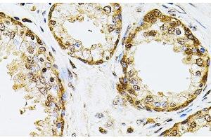 Immunohistochemistry of paraffin-embedded Human prostate using POP4 Polyclonal Antibody at dilution of 1:100 (40x lens).