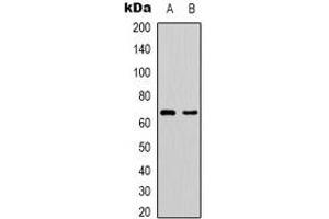 Western blot analysis of PAK1 expression in Hela (A), HEK293T (B) whole cell lysates. (PAK1 Antikörper)