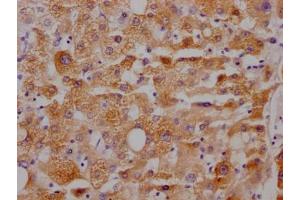 Immunohistochemistry (IHC) image for anti-Cytochrome P450, Family 3, Subfamily A, Polypeptide 4 (CYP3A4) antibody (ABIN7127448)