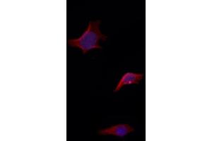 ABIN6263660 and ABIN6272968 staining HepG2 by IF/ICC.