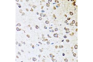 Immunohistochemistry of paraffin-embedded mouse brain using SERPINA10 antibody.