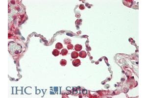 IHC-P analysis of Human Lung Tissue, with HE staining. (CHI3L1 Antikörper  (AA 112-377))