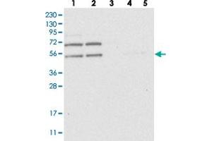 Western blot analysis of Lane 1: RT-4, Lane 2: U-251 MG, Lane 3: Human Plasma, Lane 4: Liver, Lane 5: Tonsil with C2orf30 polyclonal antibody .