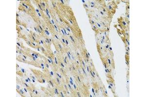Immunohistochemistry of paraffin-embedded Mouse heart using COPB2 Polyclonal Antibody at dilution of 1:100 (40x lens).