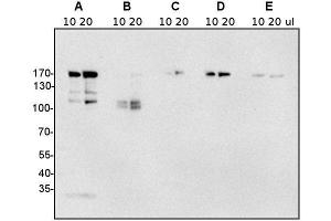 Western Blotting (WB) image for anti-Clathrin Heavy Chain (CLTC) antibody (ABIN7477856)