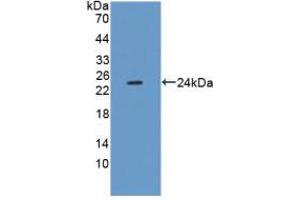 Figure. (XDH Antikörper  (AA 231-416))