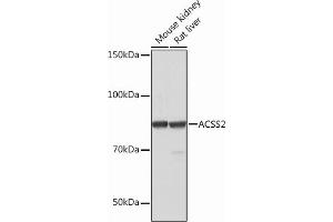 Western blot analysis of extracts of various cell lines, using  Rabbit mAb (ABIN7265427) at 1:1000 dilution. (ACSS2 Antikörper)