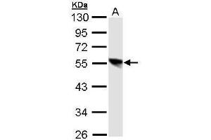 WB Image Sample (30 ug of whole cell lysate) A: 293T 10% SDS PAGE antibody diluted at 1:1000 (DP1 Antikörper)