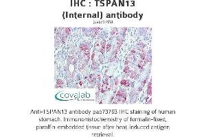 Image no. 2 for anti-Tetraspanin 13 (TSPAN13) (Internal Region) antibody (ABIN1740425) (TSPAN13 Antikörper  (Internal Region))