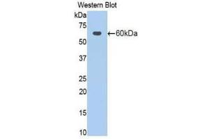 Western Blotting (WB) image for anti-Activated Leukocyte Cell Adhesion Molecule (ALCAM) (AA 28-527) antibody (ABIN1077751)