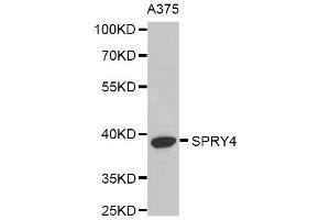 Western Blotting (WB) image for anti-Sprouty RTK Signaling Antagonist 4 (SPRY4) antibody (ABIN1980279) (SPRY4 Antikörper)