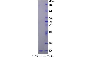 SDS-PAGE analysis of Rat Insulin Like Growth Factor 2 (IGF2) Protein.