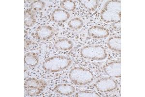 Immunohistochemistry (IHC) image for anti-ElaC Homolog 2 (ELAC2) (AA 150-200) antibody (ABIN7455053) (ELAC2 Antikörper  (AA 150-200))