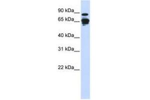 Image no. 1 for anti-Amphiphysin (AMPH) (N-Term) antibody (ABIN6743835) (Amphiphysin Antikörper  (N-Term))