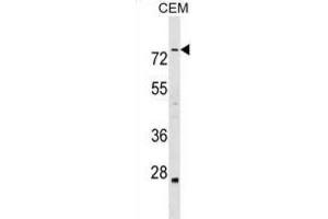 Western Blotting (WB) image for anti-Actin Binding LIM Protein Family, Member 3 (ABLIM3) antibody (ABIN2999456) (ABLIM3 Antikörper)