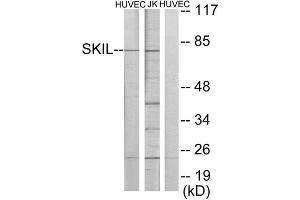 Western Blotting (WB) image for anti-SKI-Like Oncogene (SKIL) (C-Term) antibody (ABIN1849158) (SKIL Antikörper  (C-Term))