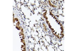 Immunohistochemistry (IHC) image for anti-Ubiquilin 4 (UBQLN4) (AA 300-390) antibody (ABIN7271124)