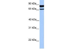 WB Suggested Anti-PDE1C Antibody Titration: 0. (PDE1C Antikörper  (N-Term))