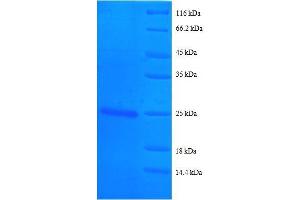 Basigin (Ok Blood Group) (BSG) (AA 138-321), (partial) protein (His tag) (CD147 Protein (AA 138-321, partial) (His tag))