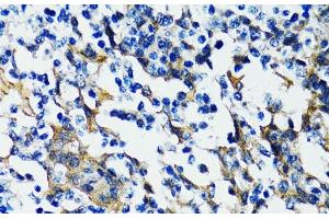 Immunohistochemistry (Paraffin-embedded Sections) (IHC (p)) image for anti-Histone Deacetylase 5 (HDAC5) antibody (ABIN7254941)