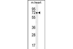 CCD Antibody (Center) (ABIN654566 and ABIN2844272) western blot analysis in mouse heart tissue lysates (35 μg/lane). (CCDC148 Antikörper  (AA 279-307))