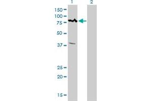 Western Blotting (WB) image for anti-Calcium Responsive Transcription Factor (CARF) (AA 621-719) antibody (ABIN599306) (Calcium Responsive Transcription Factor (CARF) (AA 621-719) Antikörper)