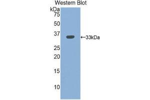 Western Blotting (WB) image for anti-Integrin beta 3 (ITGB3) (AA 134-376) antibody (ABIN1859506) (Integrin beta 3 Antikörper  (AA 134-376))