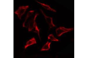ABIN6274867 staining Hela cells by IF/ICC. (ARSF Antikörper  (Internal Region))