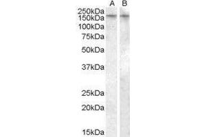 Western Blotting (WB) image for Arginine Vasopressin Receptor 1B (AVPR1B) peptide (ABIN369325) (Arginine Vasopressin Receptor 1B (AVPR1B) Peptid)