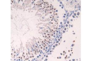 Used in DAB staining on fromalin fixed paraffin- embedded Kidney tissue (Aurora Kinase C Antikörper  (AA 20-277))