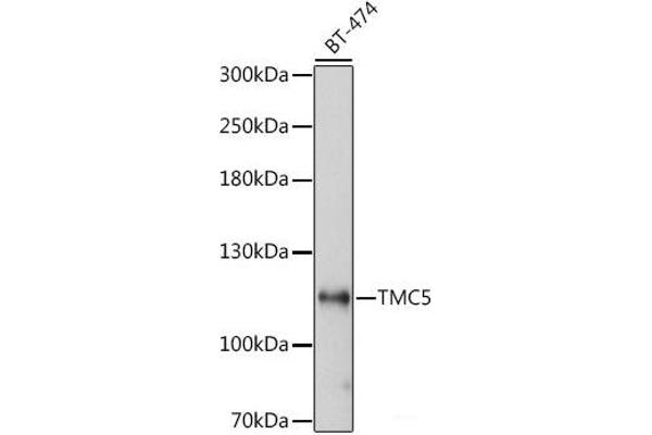 Tmc5 Antikörper