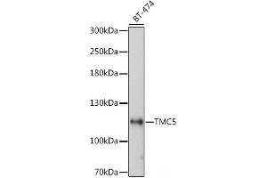Western blot analysis of extracts of BT-474 cells using TMC5 Polyclonal Antibody at dilution of 1:1000. (Tmc5 Antikörper)
