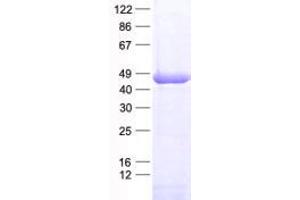 Validation with Western Blot (RAD51 Homolog B Protein (Rad51B) (His tag))