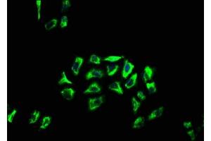 Immunofluorescence staining of Hela cells with ABIN7144431 at 1:66, counter-stained with DAPI. (APOLD1 Antikörper  (AA 213-274))