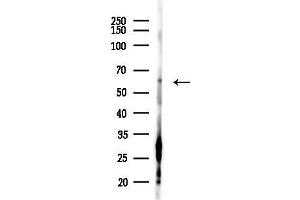 anti-SMAD, Mothers Against DPP Homolog 5 (SMAD5) (pSer463), (pSer465) antibody