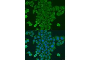 Immunofluorescence analysis of U2OS cells using DPM1 antibody (ABIN2736653) at dilution of 1:100. (DPM1 Antikörper)