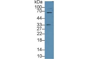 Detection of 0 in Porcine Cerebrum lysate using Polyclonal Antibody to E-selectin (Selectin E/CD62e Antikörper  (AA 260-420))